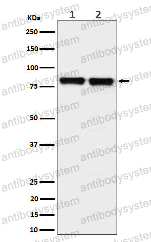 Anti-PKC delta/theta Antibody (R2C68)
