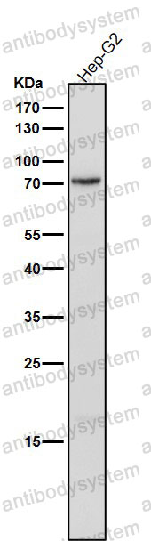 Anti-Phospho-PRKCD (Y311) Antibody (R2C69)