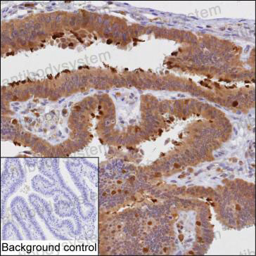 Immunohistochemical for Anti-PRKCD Antibody (R3R17) ?>