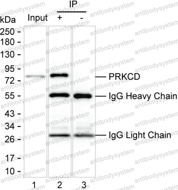 Immunoprecipitation for Anti-PRKCD Antibody (R3R17) ?>