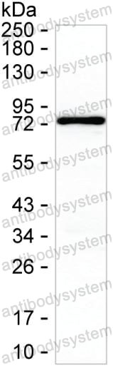 Western blot for Anti-PRKCD Antibody (R3R17) ?>