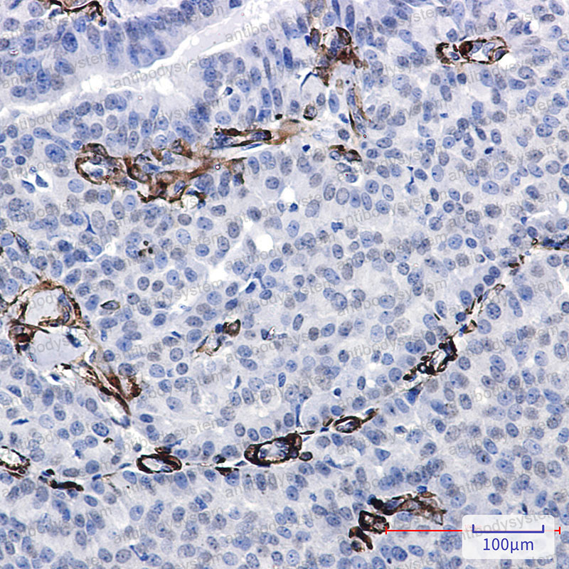 Anti-CALD1 Antibody (R2C74)