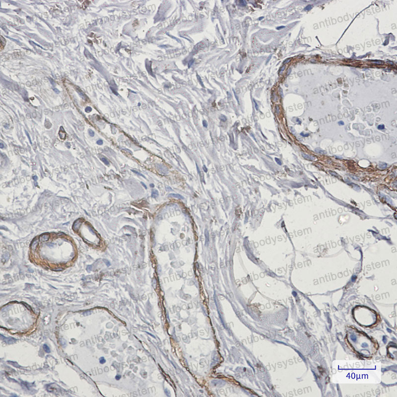 Anti-CALD1 Antibody (R2C73)