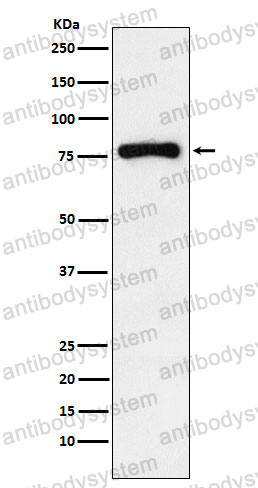 Anti-RNASEL Antibody (R2C75)