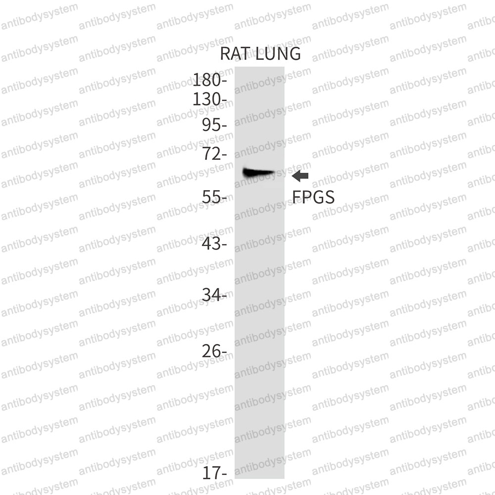 Anti-FPGS Antibody (R2C79)