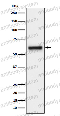 Anti-FPGS Antibody (R2C78)