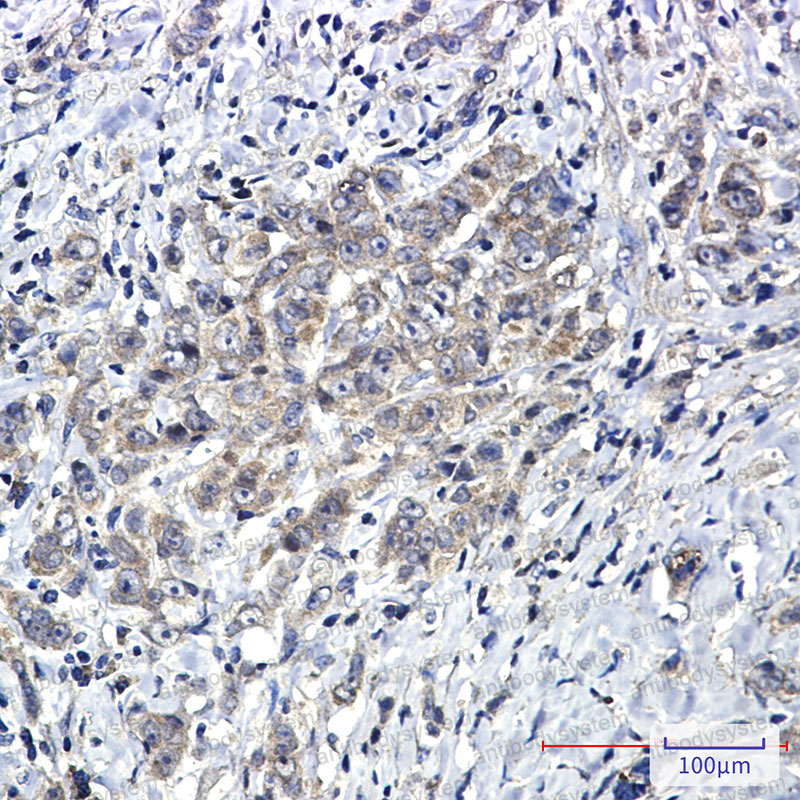 Anti-PTPN11 Antibody (R2C80)