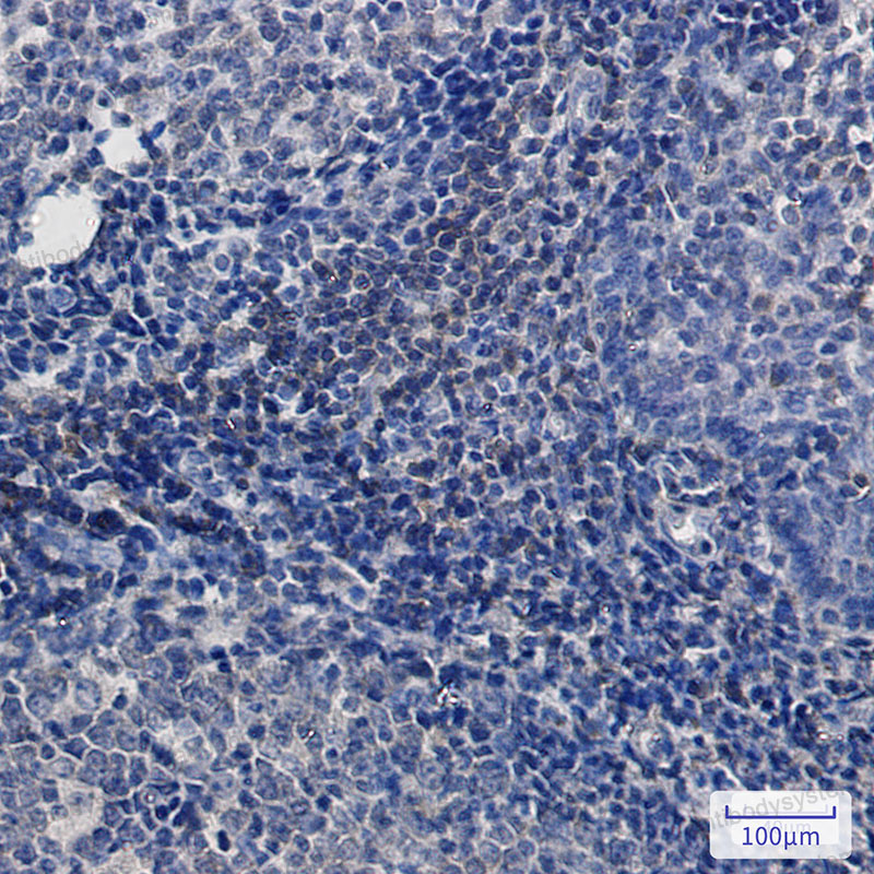 Anti-BTK Antibody (R2C81)