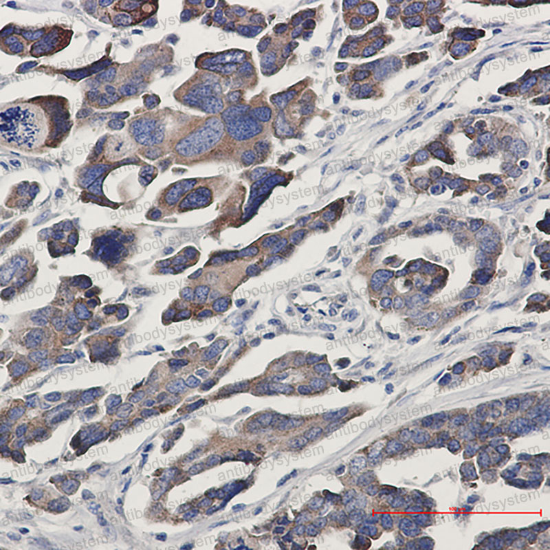 Anti-GFPT1 Antibody (R2C82)