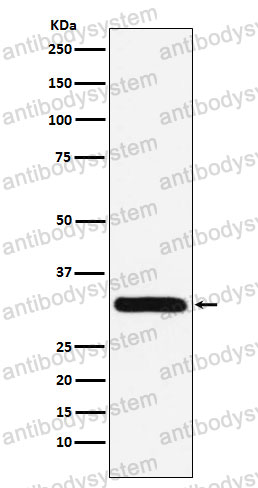 Anti-PSME1 Antibody (R2C83)