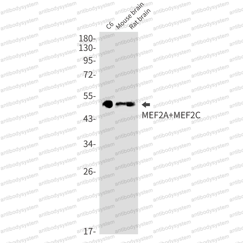 Anti-MEF2A/MEF2C Antibody (R2C87)