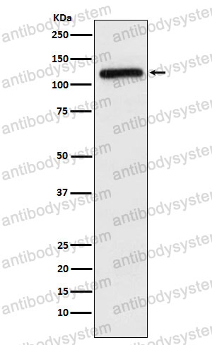 Anti-APLP2 Antibody (R2C88)