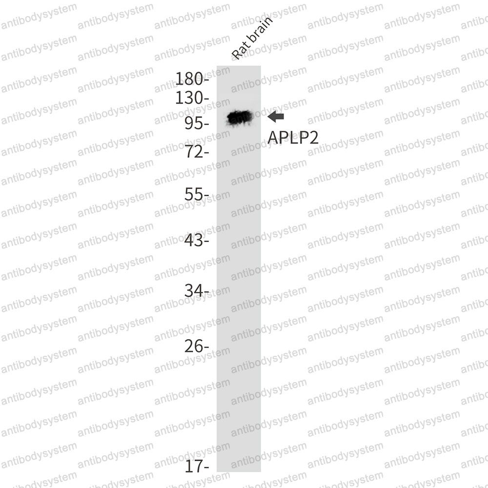 Anti-APLP2 Antibody (R2C89)