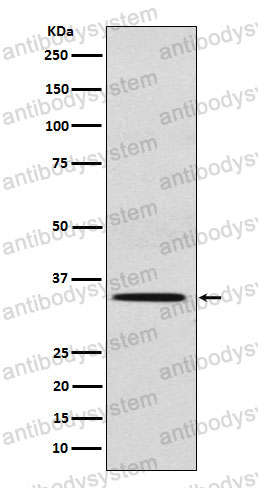 Anti-SULT2A1 Antibody (R2C90)