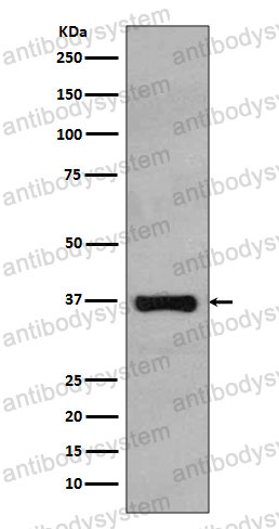 Anti-RAD51 Antibody (R1B18)