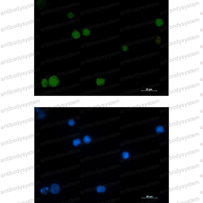 Anti-RAD51 Antibody (R2C92)
