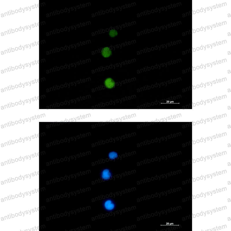 Anti-RAD51 Antibody (R2C91)