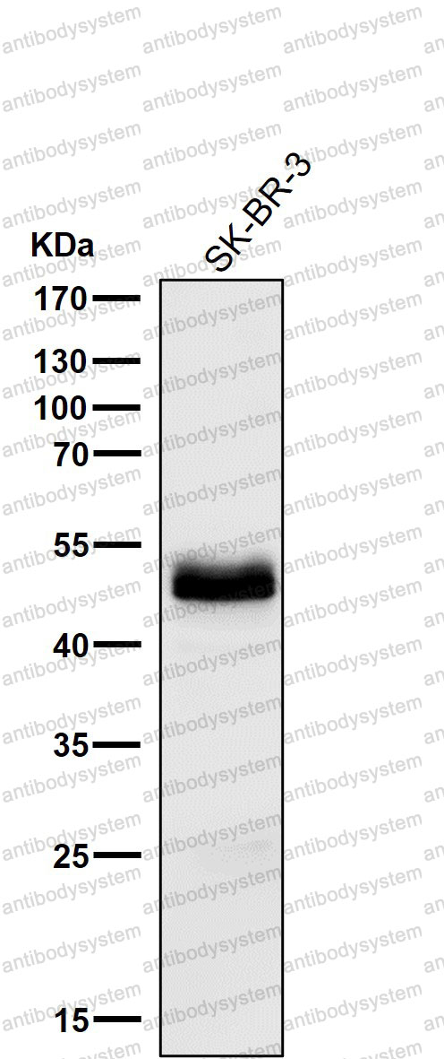 Anti-PAX8 Antibody (R2C94)