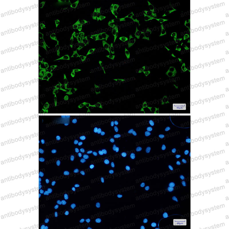Anti-FMR1 Antibody (R2C95)