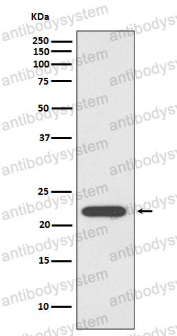Anti-PRDX1 Antibody (R2C96)
