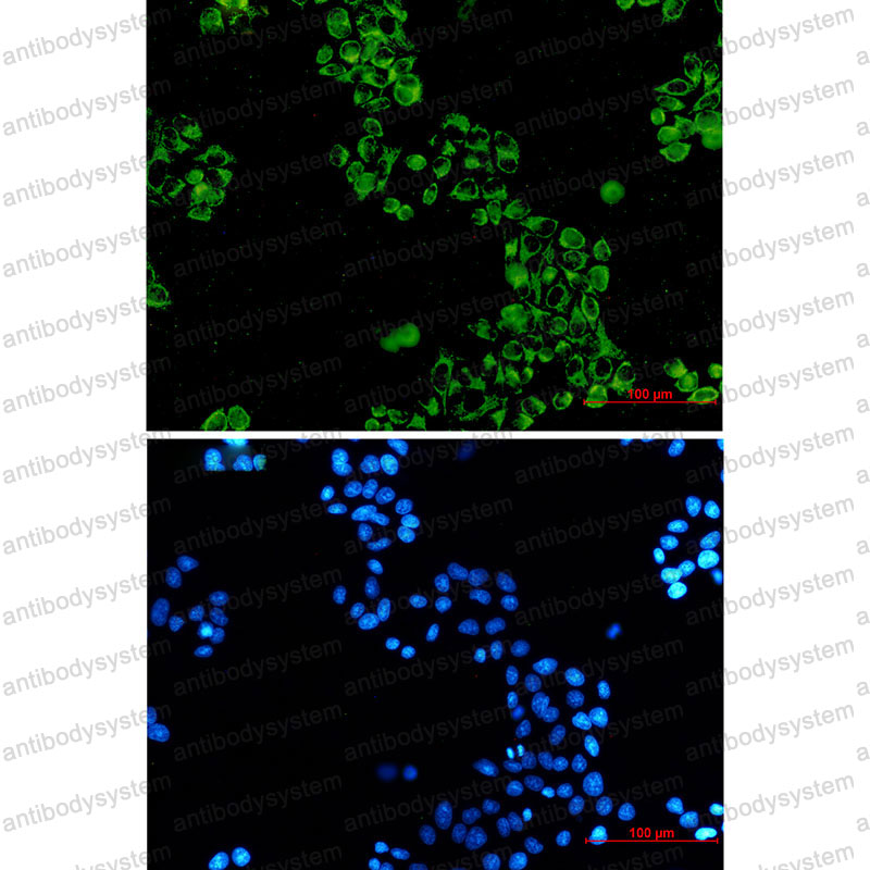Anti-C1QBP Antibody (R2D03)