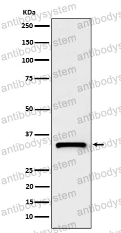 Anti-C1QBP Antibody (R2C99)