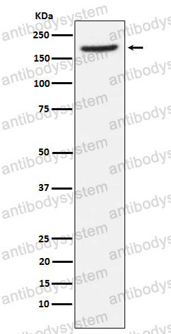 Anti-CD249/ENPEP Antibody (R2D04)