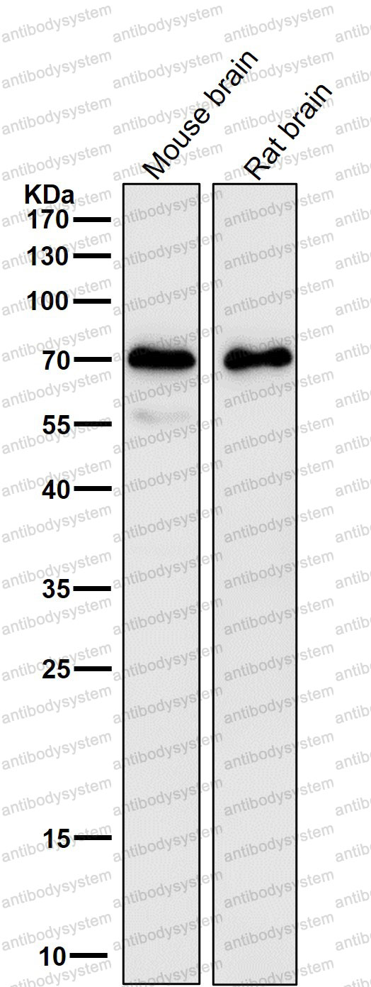 Anti-KHDRBS1 Antibody (R2D08)