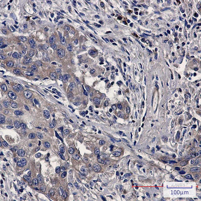 Anti-BAX Antibody (R2D11)