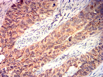 Immunohistochemical for Anti-BAX Antibody (R3R55) ?>