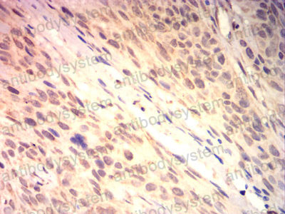 Immunohistochemical for Anti-BAX Antibody (R3R55) ?>