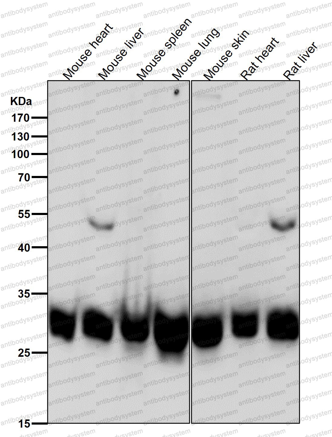 Anti-BCL2L1/Bcl-XL Antibody (R1B87)