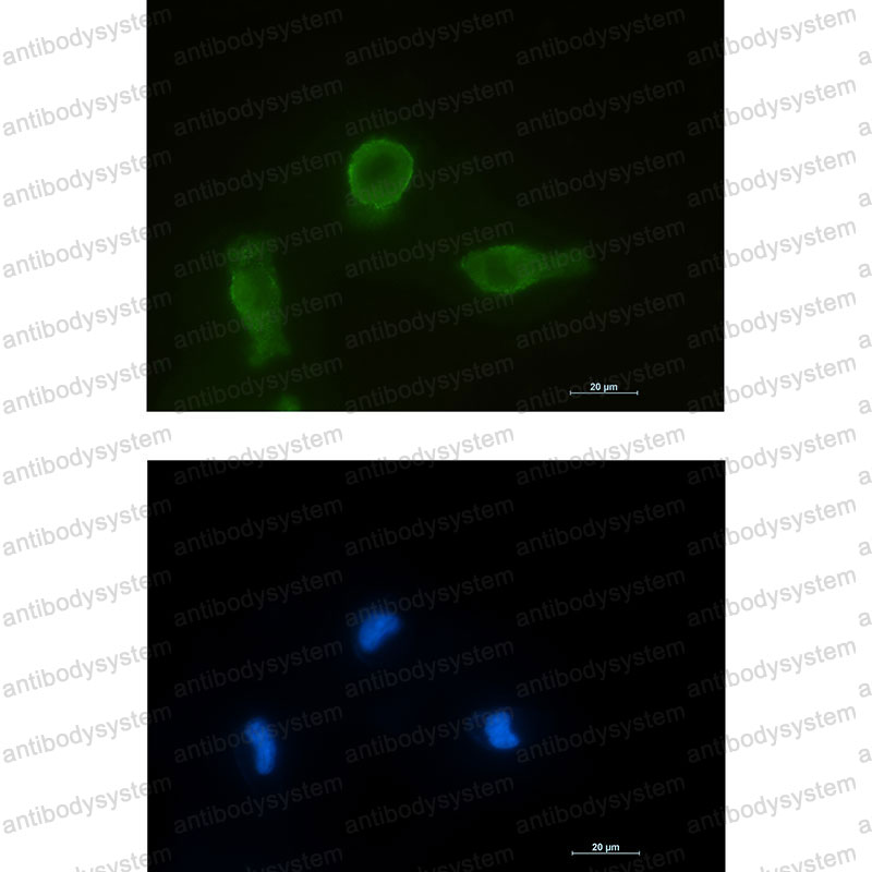 Anti-Bcl-XL/BCL2L1 Antibody (R2D12)