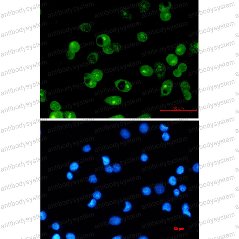 Anti-MCL1 Antibody (R2D13)