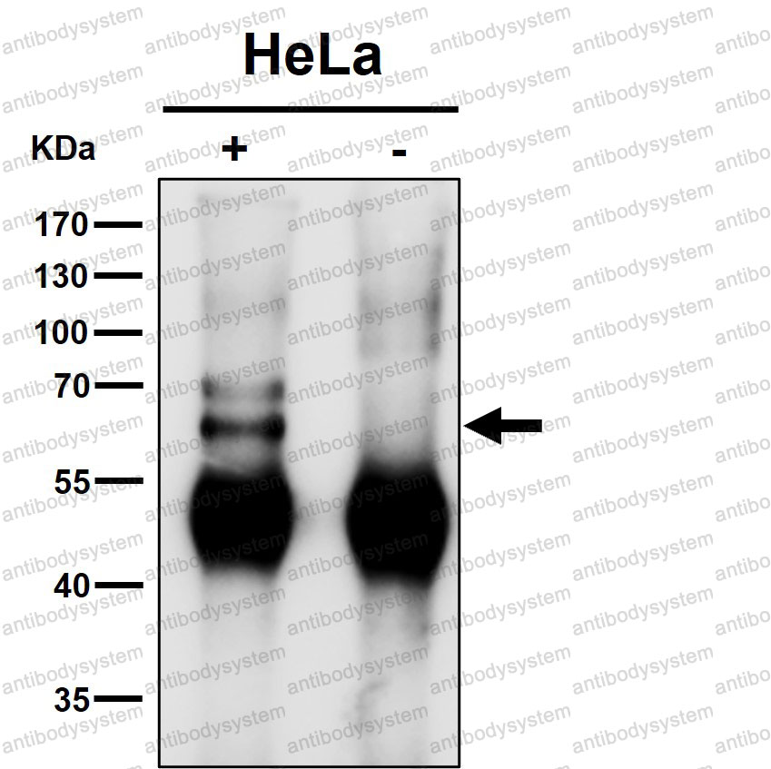 Anti-KLC1 Antibody (R2D14)