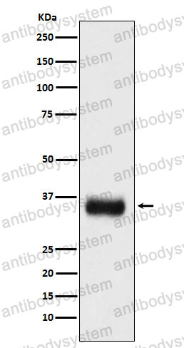 Anti-SRSF1 Antibody (R2D17)
