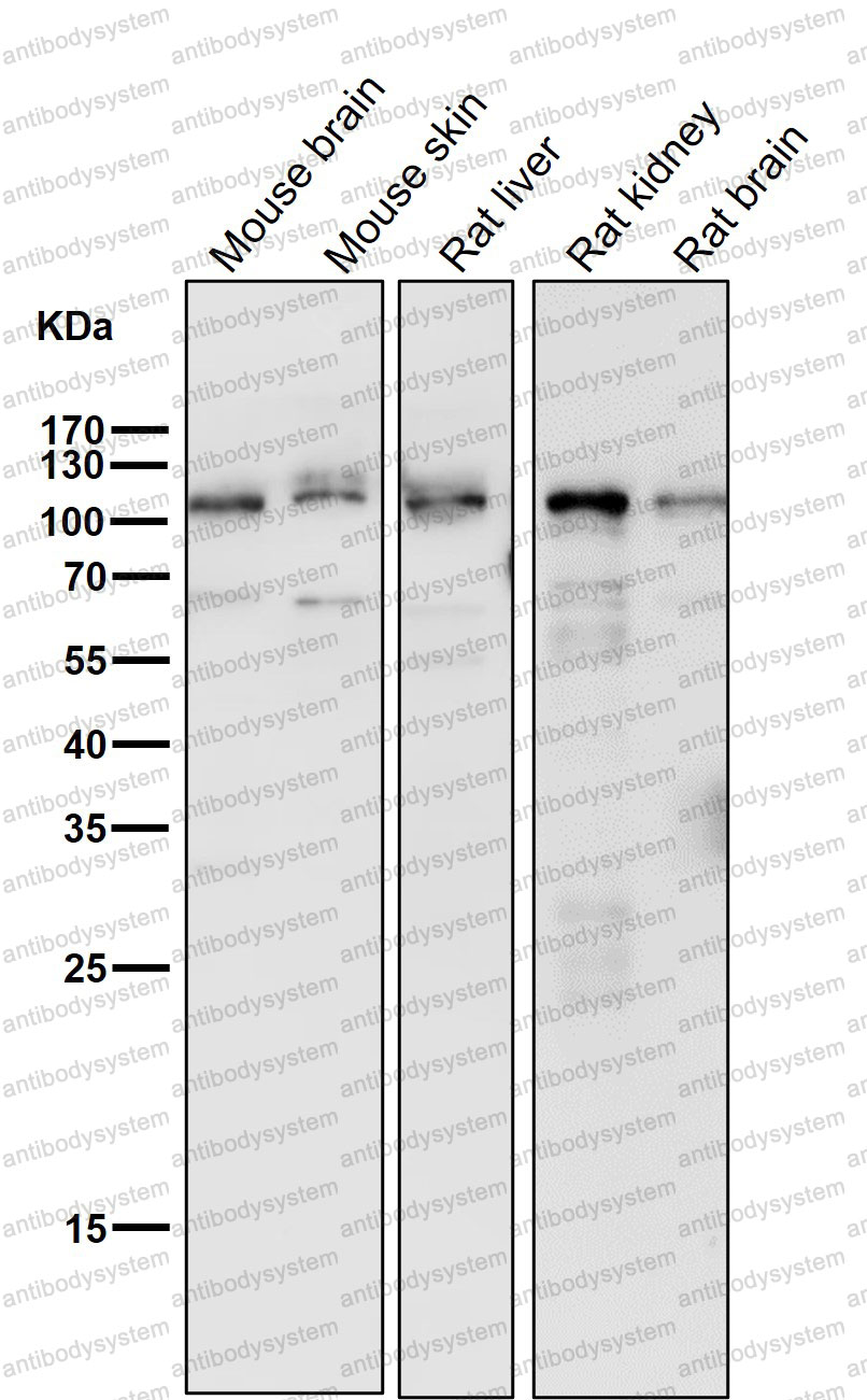Anti-DSC1 Antibody (R2D28)