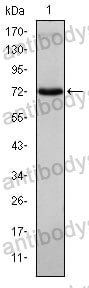 Western blot for Anti-ITK Antibody (R3R74) ?>