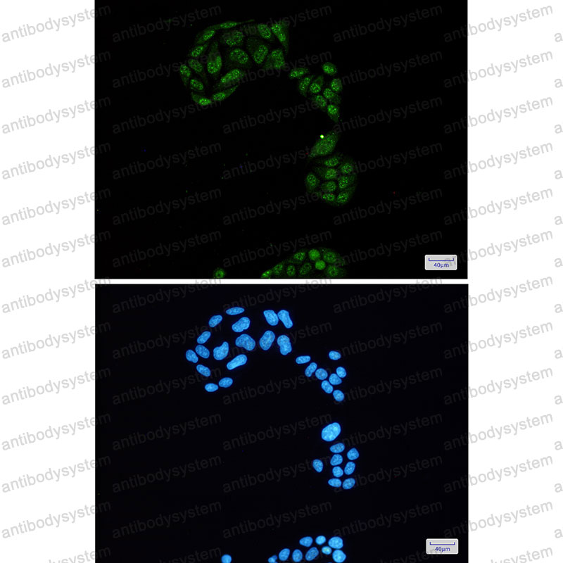 Anti-Phospho-RBL2/p130 (Ser952) Antibody (R2D30)
