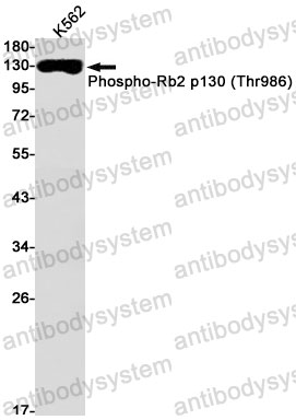 Anti-Phospho-RBL2/p130 (Thr986) Antibody (R2D29)