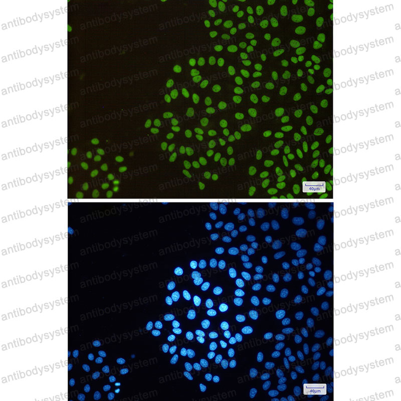 Anti-RBBP4 Antibody (R2D32)