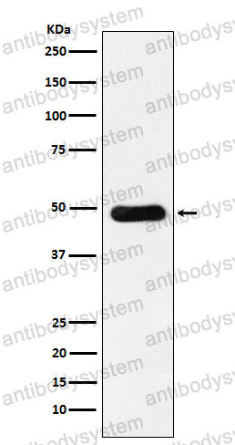 Anti-RBBP4 Antibody (R2D31)