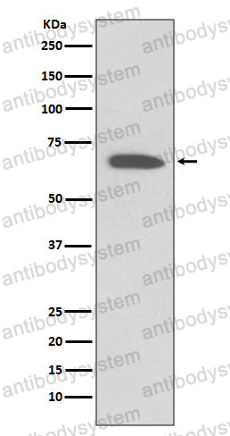 Anti-KCNA1 Antibody (R2D33)