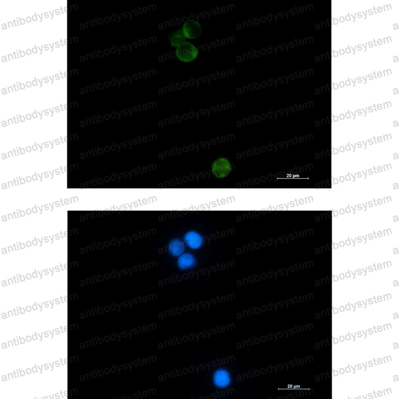 Anti-HSPA14 Antibody (R2D35)