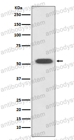 Anti-HSPA14 Antibody (R2D34)