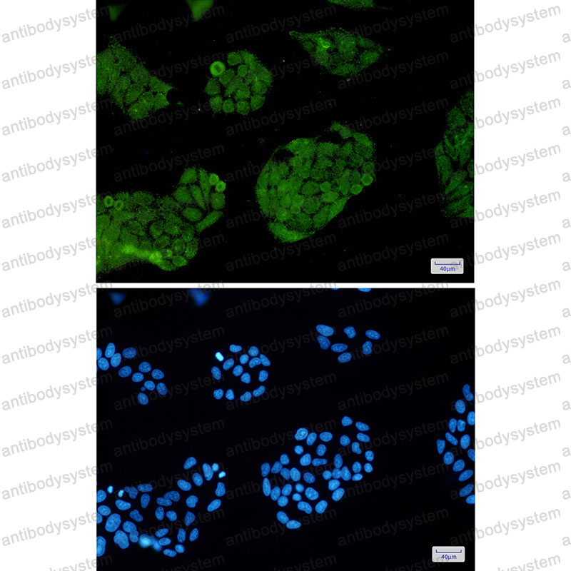 Anti-FOXO1 Antibody (R2D36)