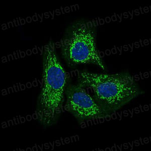 Immunofluorescence for Anti-TWF1 Antibody (R3R84) ?>
