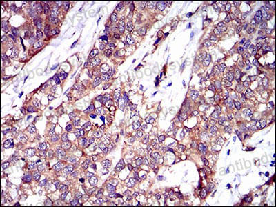 Immunohistochemical for Anti-TWF1 Antibody (R3R84) ?>