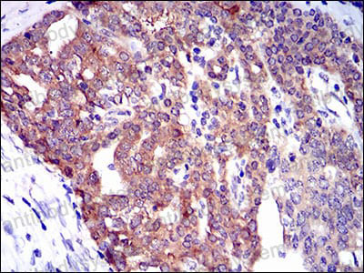 Immunohistochemical for Anti-TWF1 Antibody (R3R84) ?>