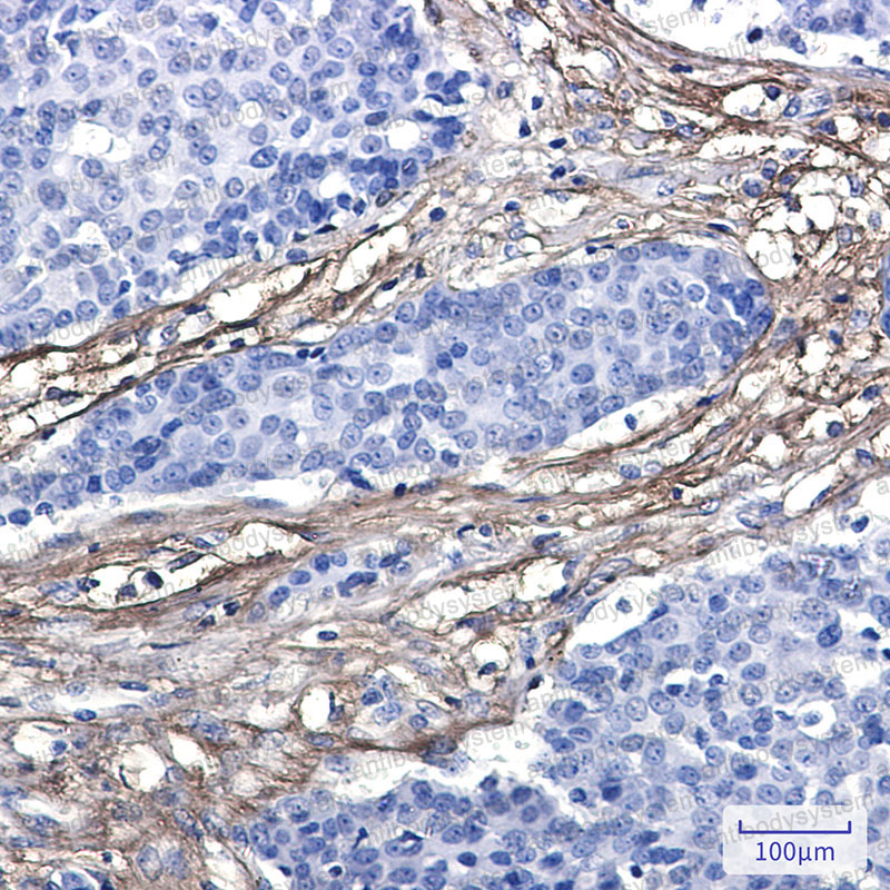 Anti-EFEMP1/Fibulin-3 Antibody (R2D37)